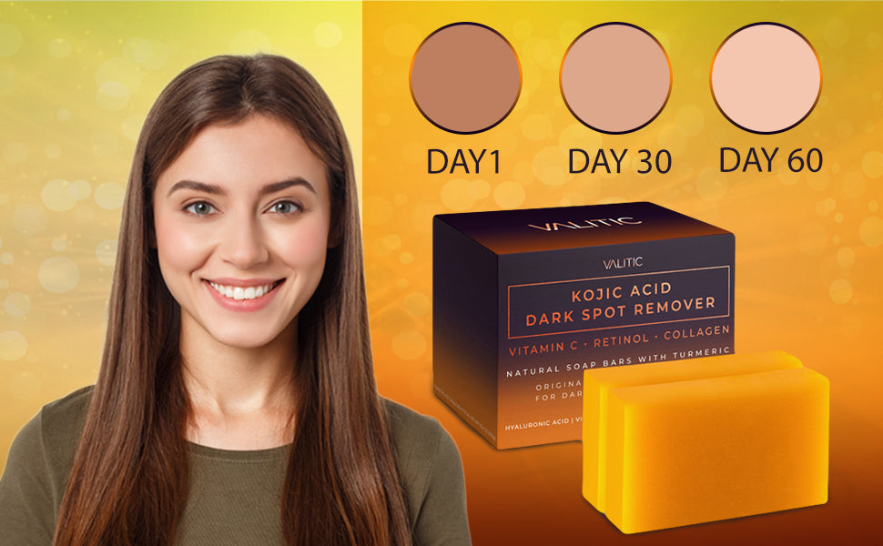 Kojic Acid Dark Spot Remover Soap Bars with Vitamin C, Retinol, Collagen, Turmeric - Original Japanese Complex Infused with Hyaluronic Acid, Vitamin E, Shea Butter, Castile Olive Oil (2 Pack)